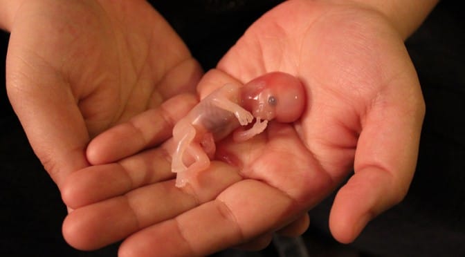 Et si on parlait des effets graves des vaccins COVID sur les femmes enceintes ?