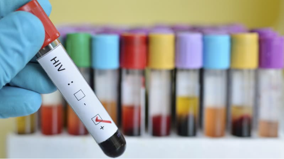 Selon les CDC, les vaccins Covid sont inopérants chez les séropositifs