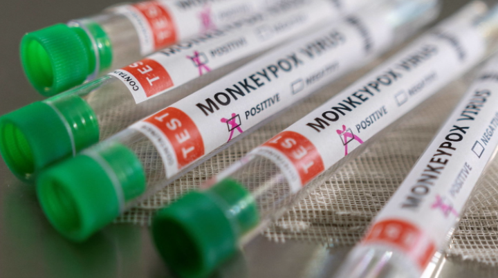 Nouveau vent de panique mondial autour du Mpox