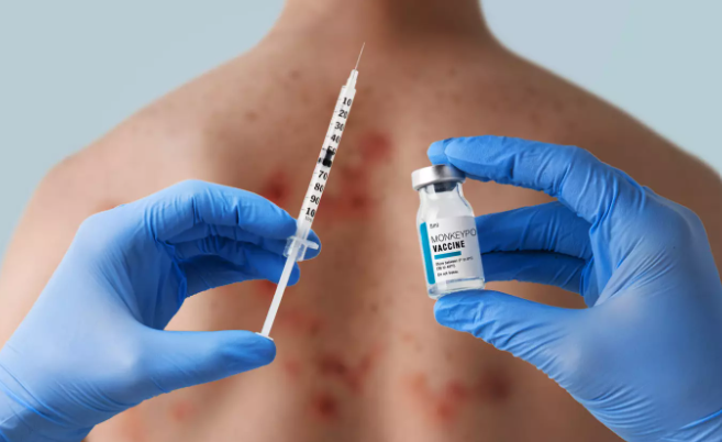 Royaume-Uni : la vaccination Mpox comme nouvelle obsession de la bureaucratie sanitaire