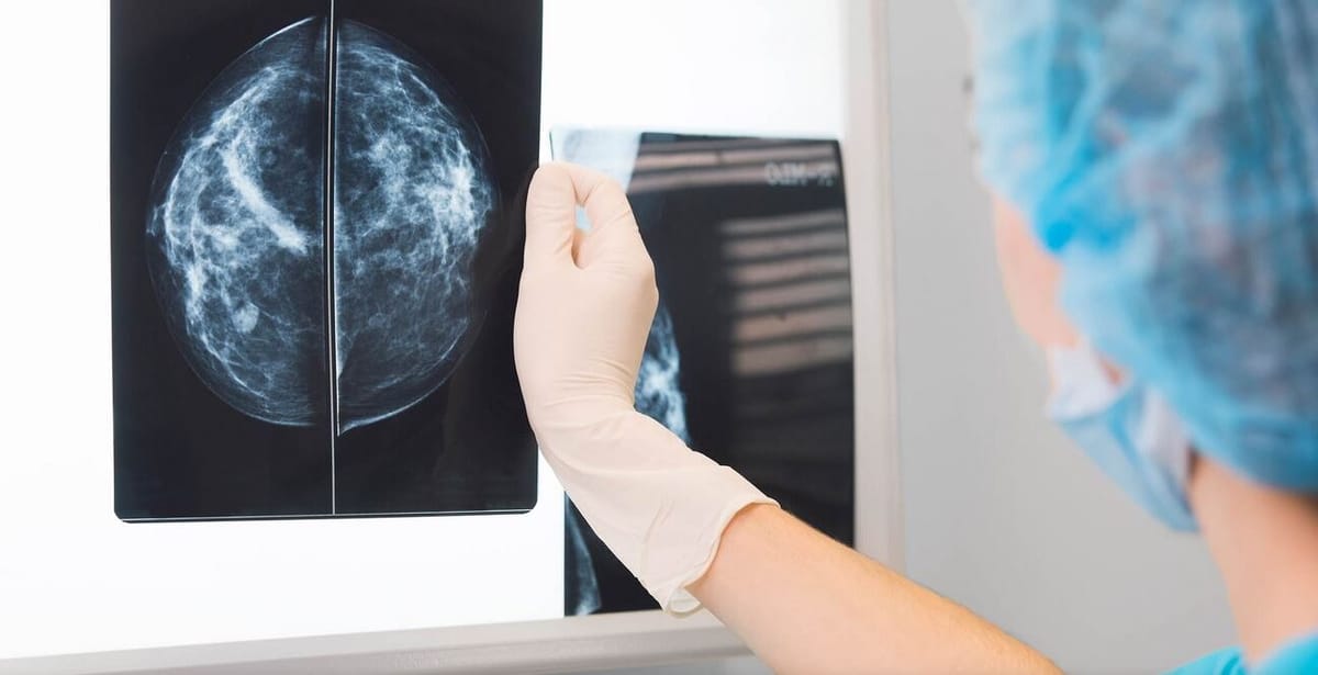 Royaume -Uni : le cancer de la prostate, l’oublié du confinement
