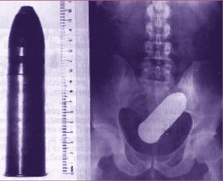 Chronique de la folie ordinaire de la France contemporaine