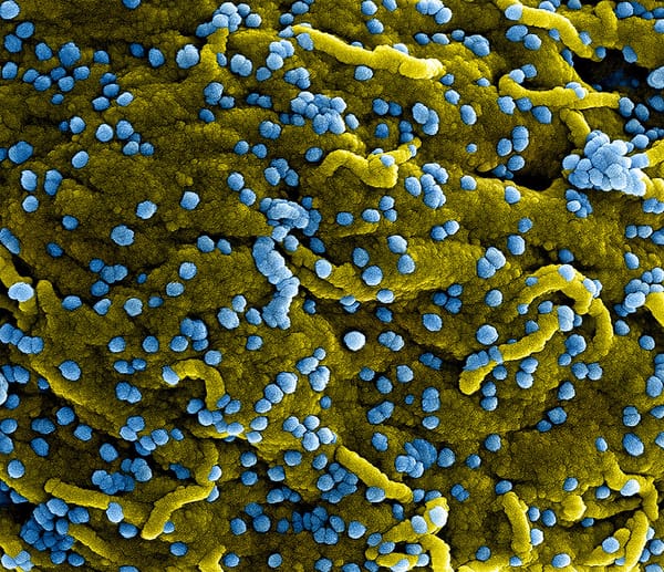 Le coronavirus a tué 90 personnes durant ces dernières 24 heures