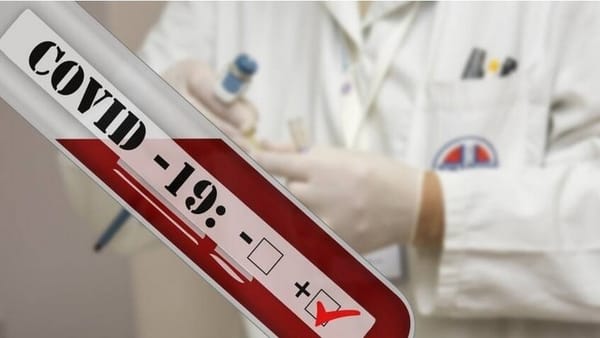 [PAYANT] Quelles économies l’assurance-maladie fera-t-elle sur les non-vaccinés ?