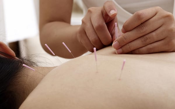 L’acupuncture : un art médical ancestral