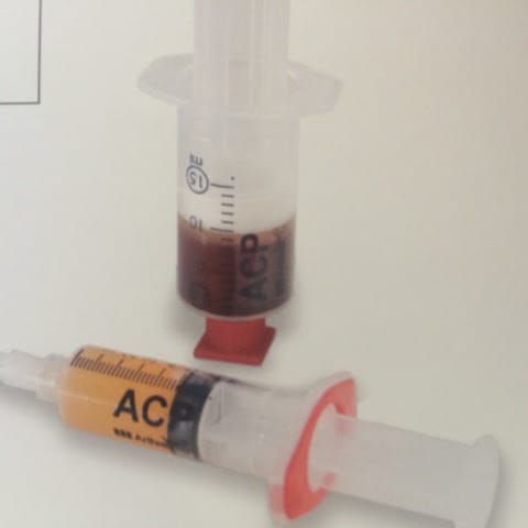 Des profils uniques de protéines plasmatiques découverts chez des patients atteints de Covid long