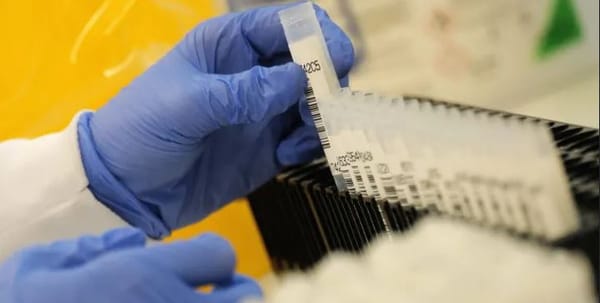 Covid-19 : Le B.1.640.2 plus connu comme « variant IHU », est un « variant sous surveillance »