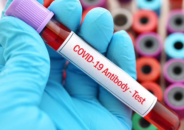 Une étude US découvre le double rôle des anticorps dans les infections COVID