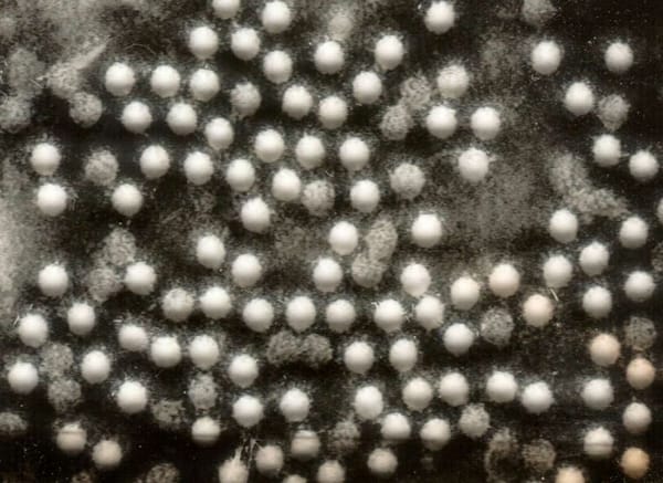 Vers une épidémie de polio en Ukraine ?