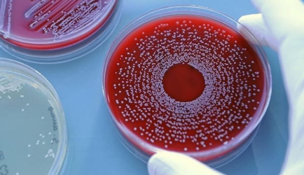 La pollution à l’origine de superbactéries mortelles, alerte l’ONU