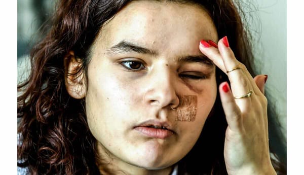 Gilets Jaunes : aucune condamnation contre les policiers éborgneurs