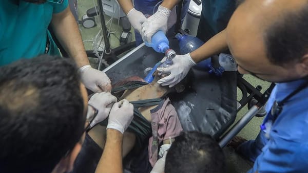 Meyssan : « Un tiers des amputations sans anesthésie à Gaza se fait sur des enfants »