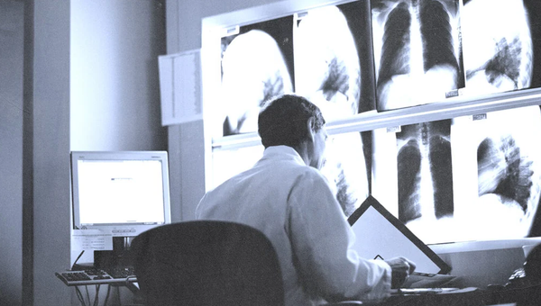 Un million de cas de cancer masqués par le Covid