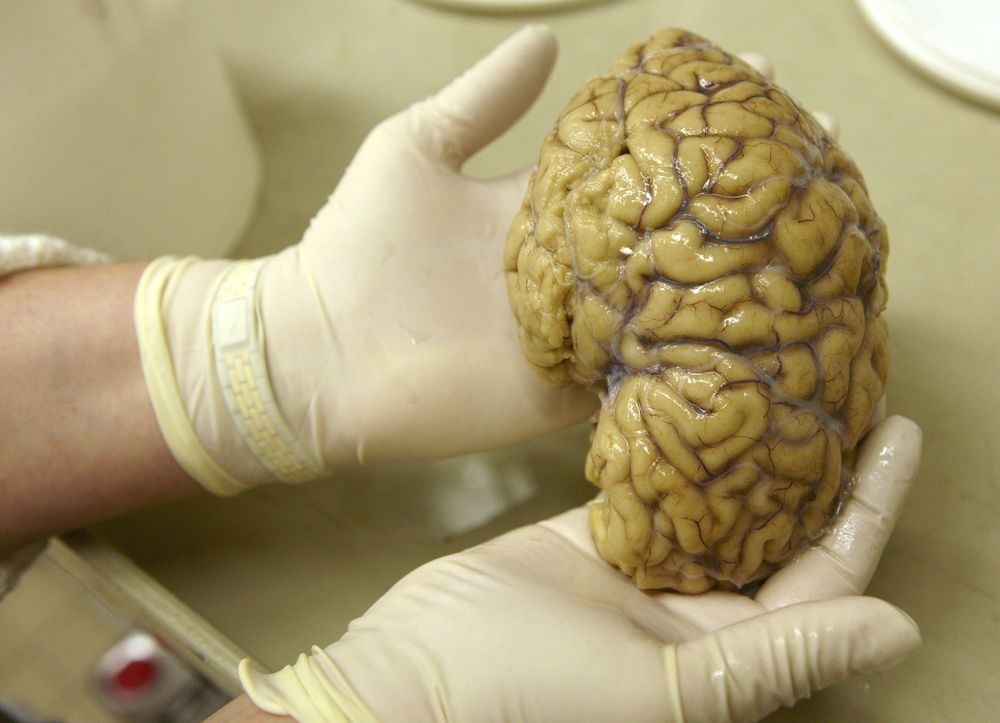 Que trouve-t-on dans le cerveau d'un macroniste aujourd'hui ?