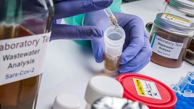 La surveillance des eaux usées, pour anticiper les futures épidémies